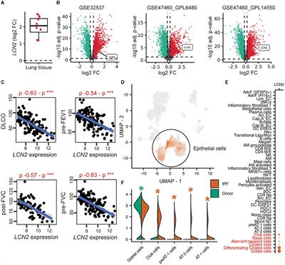 Increased lipocalin-2 expression in pulmonary inflammation and fibrosis